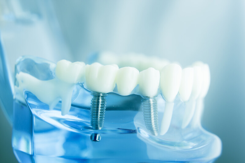 Does Gum Disease Affect Dental Implant Surgery? | The Tribune World